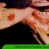 نکاتی جهت پیشگیری دام به بیماری تب برفکی