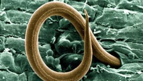 کنترل نماتدهای انگل گیاهی با آفتابدهی خاک