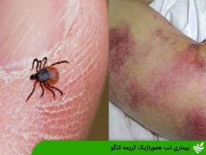 بیماری تب هموراژیک کریمه کنگو