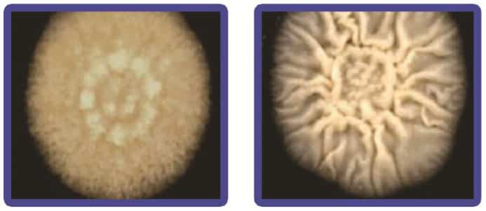 شکل-۱۱ رشد قارچ مخمری Nematospora coryli روی محیط کشت AFM (چروکیدگی سطح پرگنه ها و رشد رشته ای قارچ در حاشیه پرگنه مشهود)