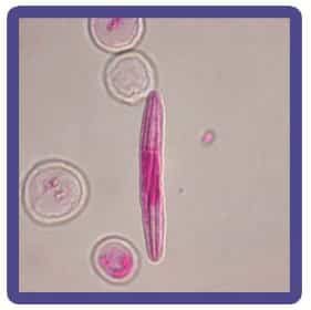 شکل ۱۲- شکل میکروسکوپی قارچ Nematospora coryli آسک و سلول های مخمری جدا شده از ریسه