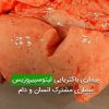 بیماری باکتریایی لپتوسپیروزیس بیماری مشترک انسان و دام