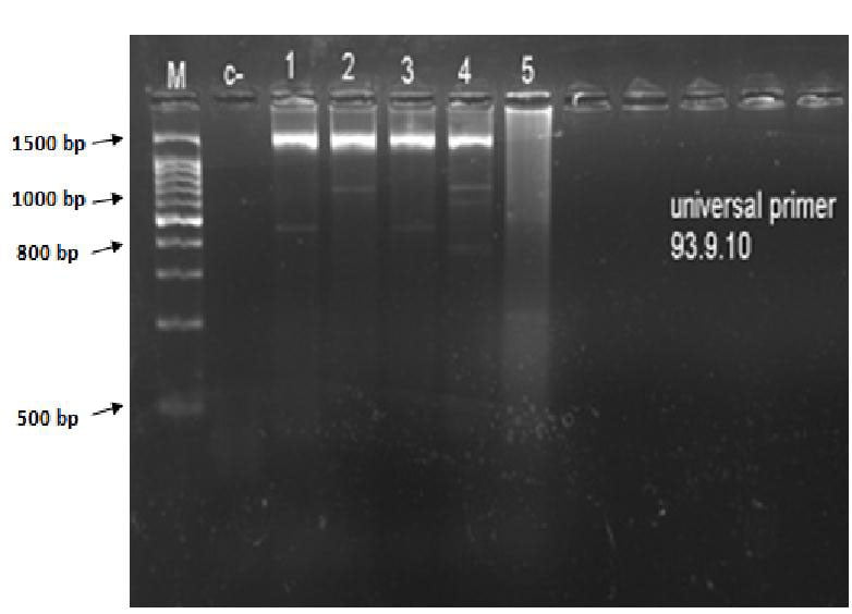 الکتروفورز ژل آگارز 1/5% مربوط به محصول PCR با
پرایمر یونیورسال و باند در bp 1500