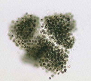 Phylum : Cyanobacteria
Genus : Microcystis