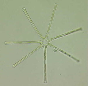 Phylum : Ochrophyta
Genus : Asterionella