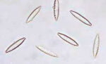 Phylum : Ochrophyta
Genus : Nitzschia