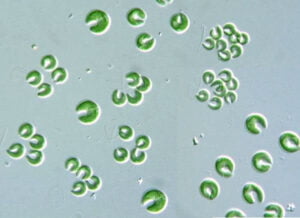 Phylum : Chlorophyta
Genus : Kirchneriella