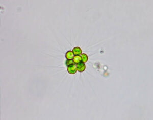 Phylum : Chlorophyta
Genus : Micractinium