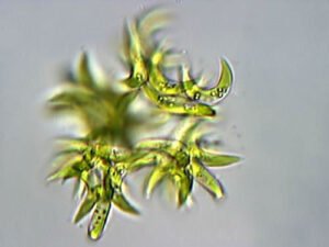 Phylum : Chlorophyta
Genus : Selenastrum