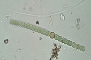 Phylum : Cyanobacteria
Genus : Anabaena