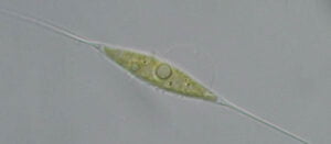 Phylum : Chlorophyta
Genus : Schroederia