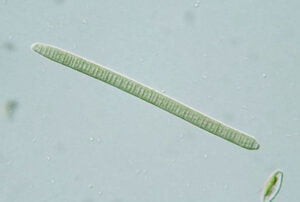 Phylum : Cyanobacteria
Genus : Oscillatoria