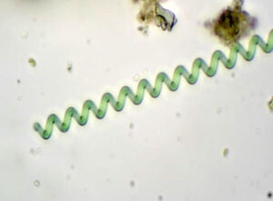 Phylum : Cyanobacteria
Genus : Spirulina