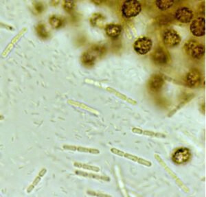 Phylum : Cyanobacteria
Genus : Phormidium