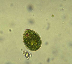 Phylum : Euglenozoa
Genus : Lepocinclis