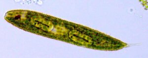 Phylum : Euglenozoa
Genus : Euglena