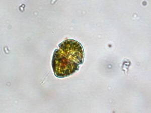 Phylum : Myzozoa
Genus : Gymnodinium