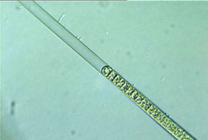 Phylum : Cyanobacteria
Genus : Lungbya