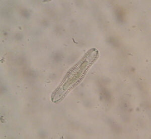 Phylum : Ochrophyta
Genus : Rhopalodia