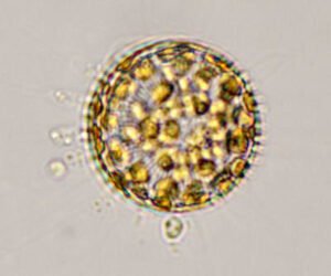 Phylum : Ochrophyta
Genus : Stephanodiscus