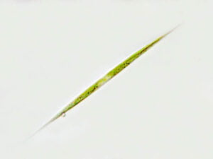 Phylum : Chlorophyta
Genus : Ankistrodesmus