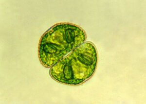 Phylum : Chlorophyta
Genus : Cosmarium