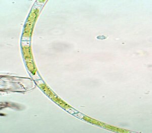 Phylum : Chlorophyta
Genus : Mougeotia