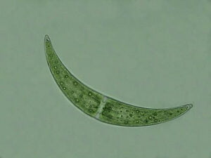 Phylum : Chlorophyta
Genus : Closterium