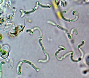 Phylum : Cyanobacteria
Genus : Romeria