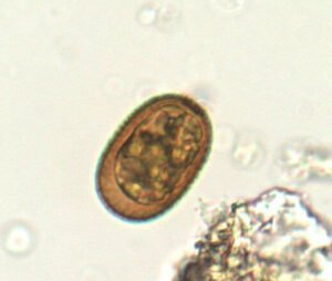 Phylum : Euglenozoa
Genus : Trachelomonas